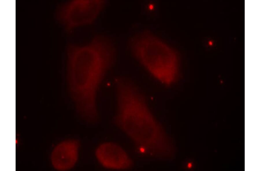 Immunofluorescence - LIMK1 (Phospho-Thr508) Antibody from Signalway Antibody (11126) - Antibodies.com