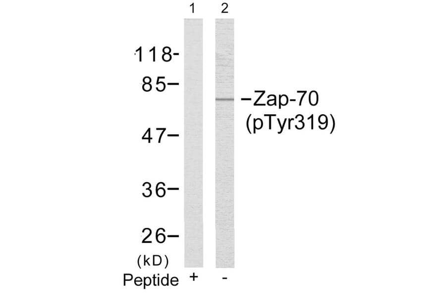Western blot - Zap-70 (Phospho-Tyr319) Antibody from Signalway Antibody (11159) - Antibodies.com