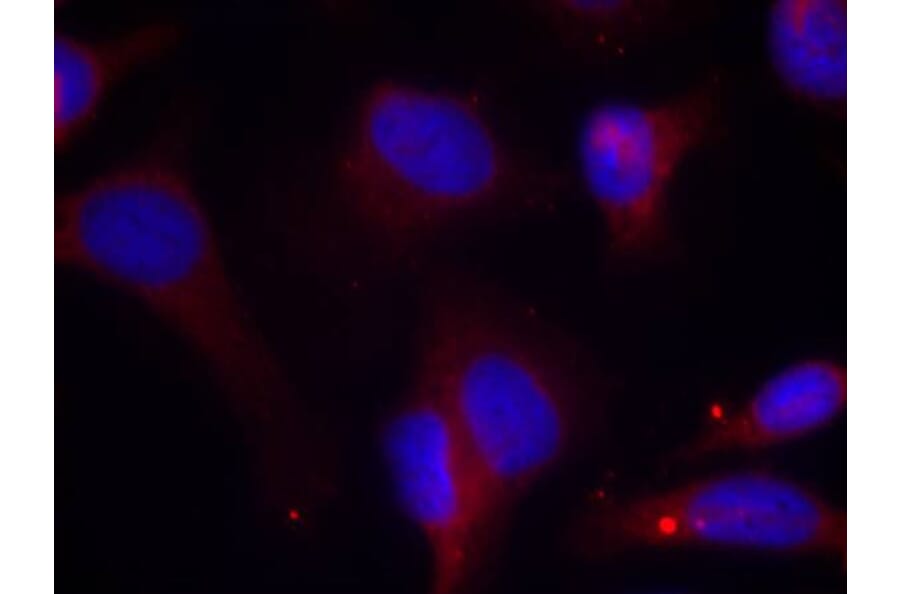 Immunofluorescence - Zap-70 (Phospho-Tyr319) Antibody from Signalway Antibody (11159) - Antibodies.com