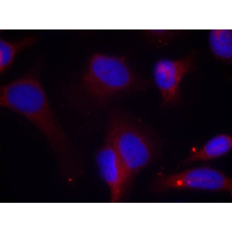 Immunofluorescence - Zap-70 (Phospho-Tyr319) Antibody from Signalway Antibody (11159) - Antibodies.com