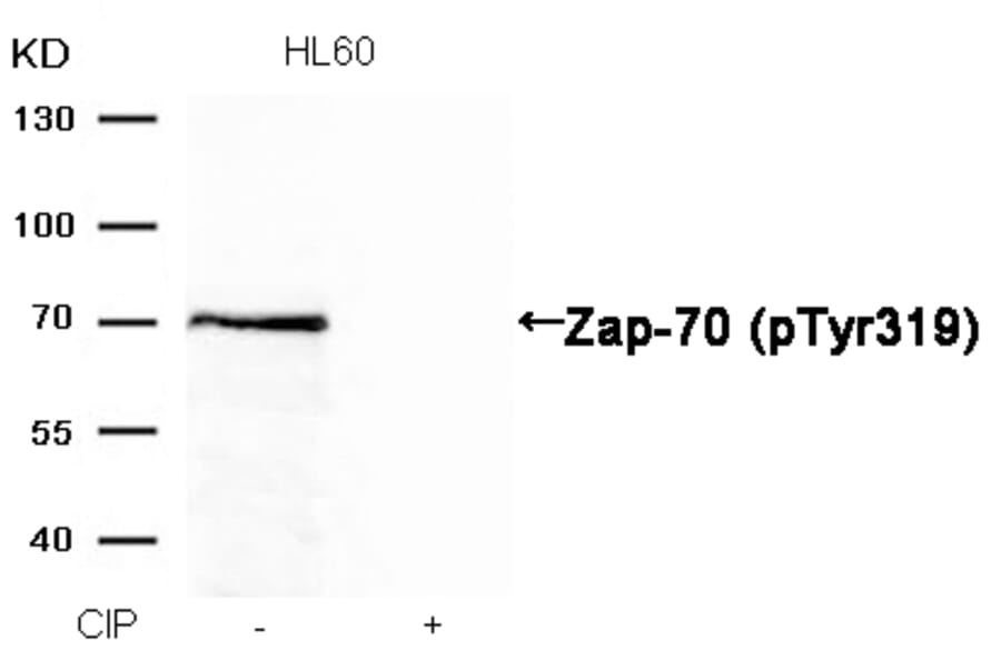 Western blot - Zap-70 (Phospho-Tyr319) Antibody from Signalway Antibody (11159) - Antibodies.com