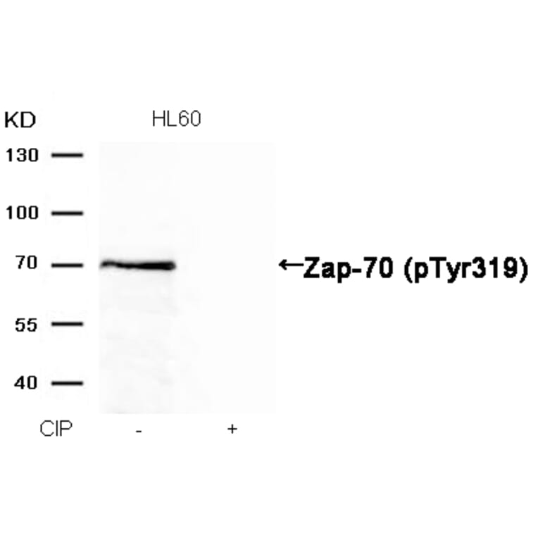 Western blot - Zap-70 (Phospho-Tyr319) Antibody from Signalway Antibody (11159) - Antibodies.com