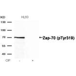 Western blot - Zap-70 (Phospho-Tyr319) Antibody from Signalway Antibody (11159) - Antibodies.com