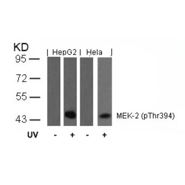 Western blot - MEK2 (Phospho-Thr394) Antibody from Signalway Antibody (11008) - Antibodies.com