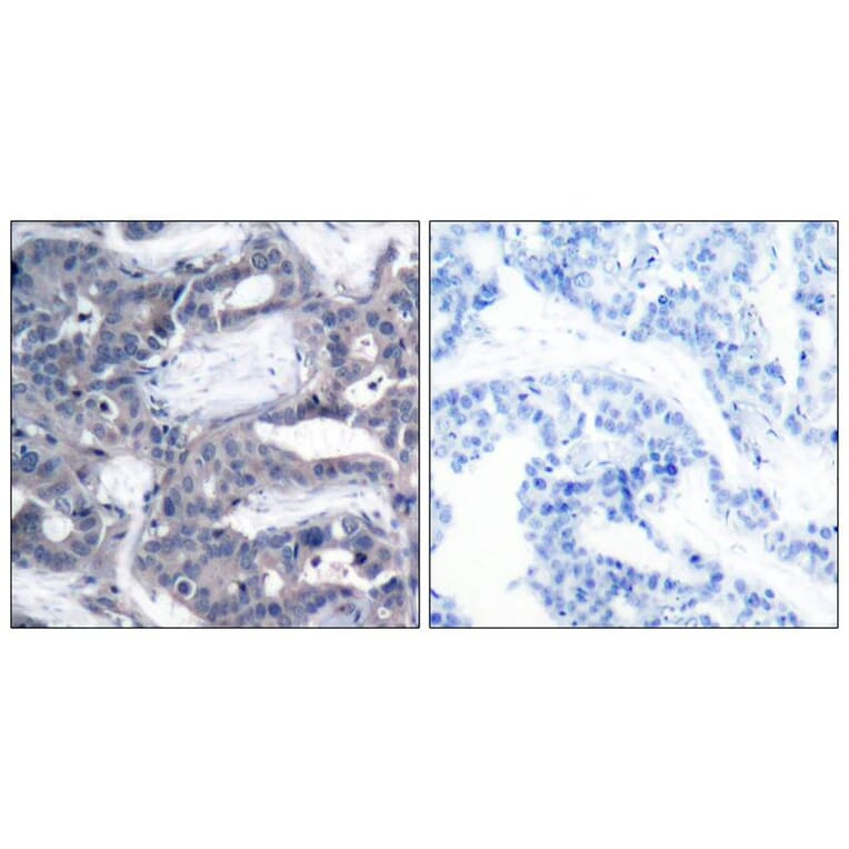 Immunohistochemistry - MEK2 (Phospho-Thr394) Antibody from Signalway Antibody (11008) - Antibodies.com