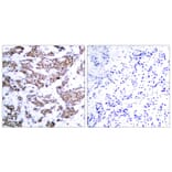 Immunohistochemistry - MEF2a (Phospho-Thr312) Antibody from Signalway Antibody (11039) - Antibodies.com