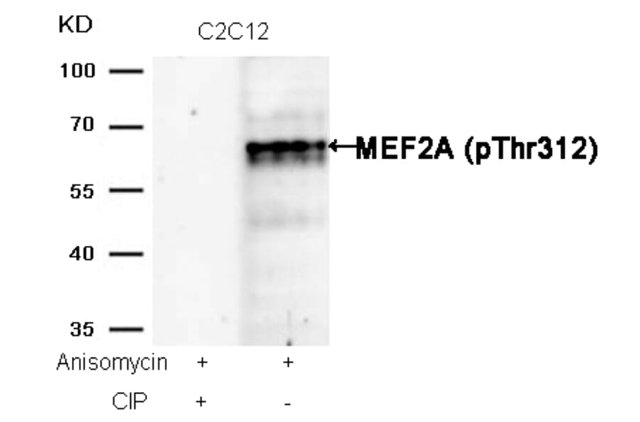 Western blot - MEF2a (Phospho-Thr312) Antibody from Signalway Antibody (11039) - Antibodies.com