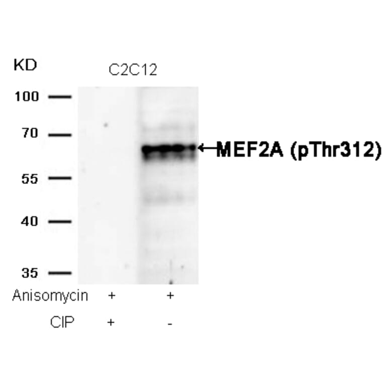 Western blot - MEF2a (Phospho-Thr312) Antibody from Signalway Antibody (11039) - Antibodies.com