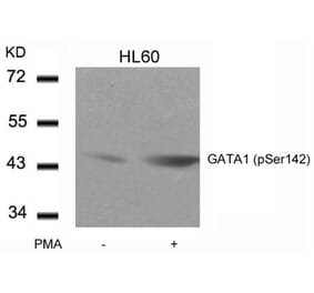 Western blot - GATA1 (Phospho-Ser142) Antibody from Signalway Antibody (11041) - Antibodies.com