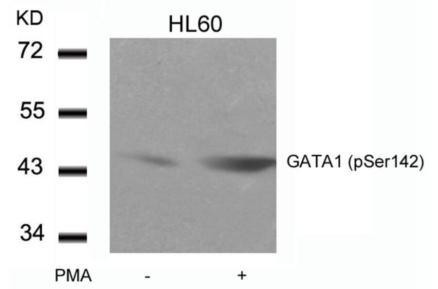 Western blot - GATA1 (Phospho-Ser142) Antibody from Signalway Antibody (11041) - Antibodies.com