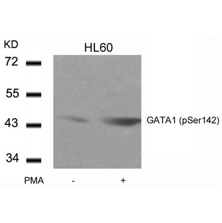 Western blot - GATA1 (Phospho-Ser142) Antibody from Signalway Antibody (11041) - Antibodies.com