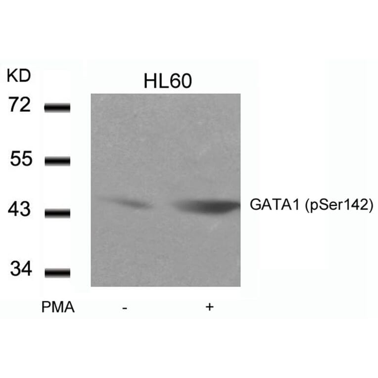 Western blot - GATA1 (Phospho-Ser142) Antibody from Signalway Antibody (11041) - Antibodies.com