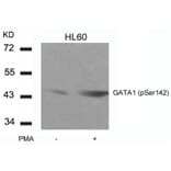 Western blot - GATA1 (Phospho-Ser142) Antibody from Signalway Antibody (11041) - Antibodies.com