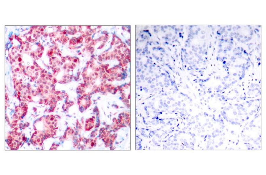 Immunohistochemistry - GATA1 (Phospho-Ser142) Antibody from Signalway Antibody (11041) - Antibodies.com