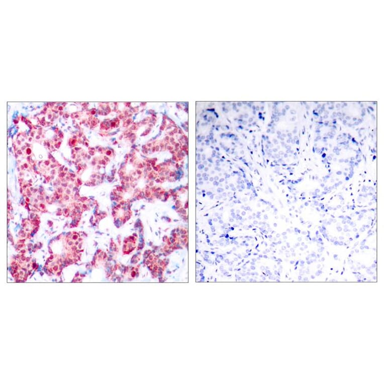Immunohistochemistry - GATA1 (Phospho-Ser142) Antibody from Signalway Antibody (11041) - Antibodies.com