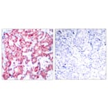 Immunohistochemistry - GATA1 (Phospho-Ser142) Antibody from Signalway Antibody (11041) - Antibodies.com