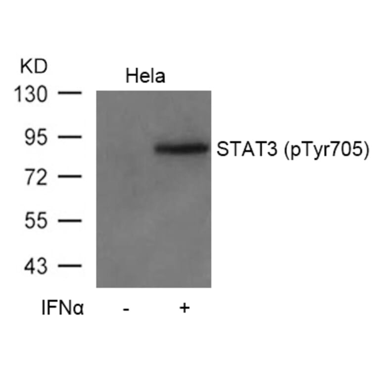 Western blot - STAT3 (Phospho-Tyr705) Antibody from Signalway Antibody (11045) - Antibodies.com