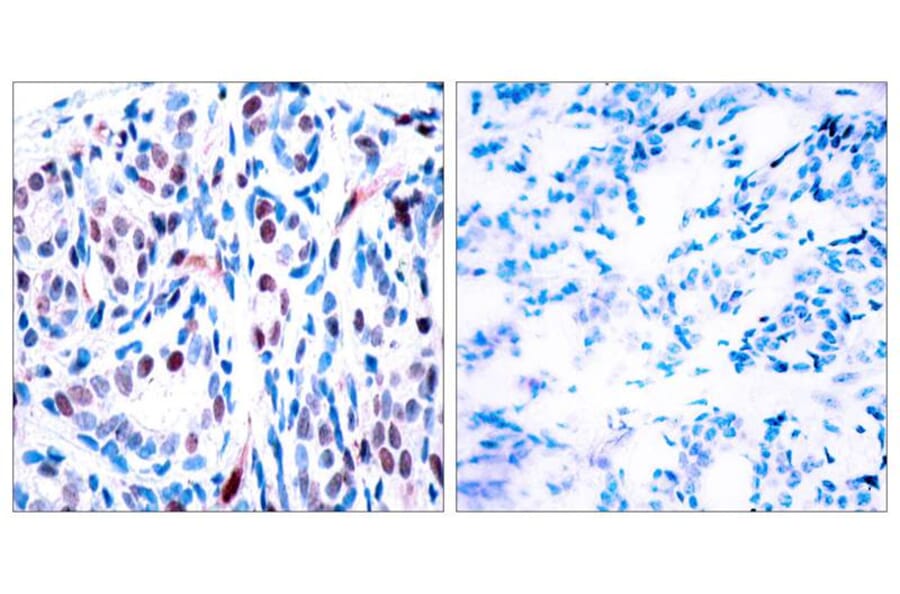 Immunohistochemistry - STAT3 (Phospho-Tyr705) Antibody from Signalway Antibody (11045) - Antibodies.com
