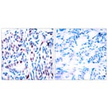 Immunohistochemistry - STAT3 (Phospho-Tyr705) Antibody from Signalway Antibody (11045) - Antibodies.com