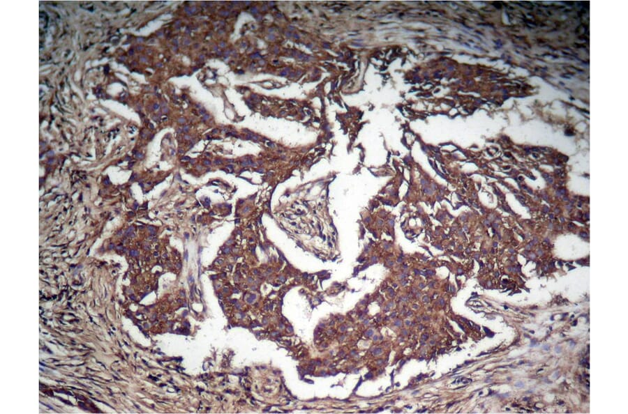 Immunohistochemistry - STAT3 (Phospho-Tyr705) Antibody from Signalway Antibody (11045) - Antibodies.com