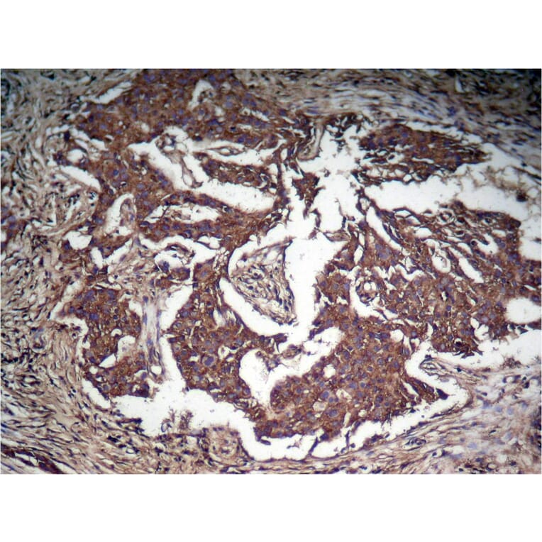 Immunohistochemistry - STAT3 (Phospho-Tyr705) Antibody from Signalway Antibody (11045) - Antibodies.com