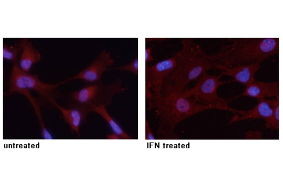 Immunofluorescence - STAT3 (Phospho-Tyr705) Antibody from Signalway Antibody (11045) - Antibodies.com