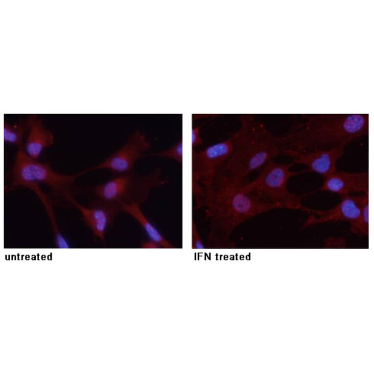 Immunofluorescence - STAT3 (Phospho-Tyr705) Antibody from Signalway Antibody (11045) - Antibodies.com