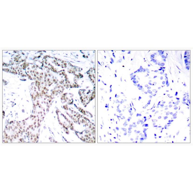 Immunohistochemistry - STAT3 (Phospho-Ser727) Antibody from Signalway Antibody (11046) - Antibodies.com