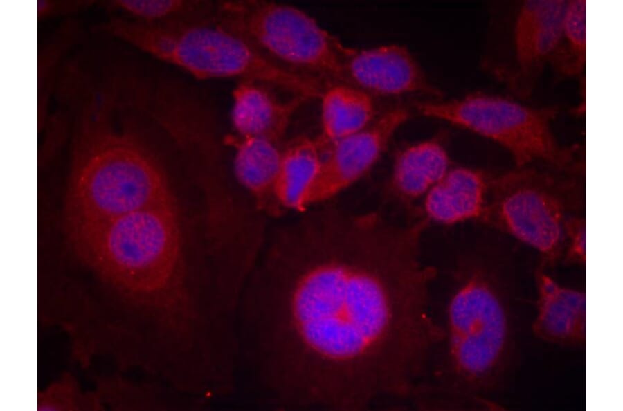Immunofluorescence - STAT3 (Phospho-Ser727) Antibody from Signalway Antibody (11046) - Antibodies.com