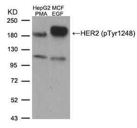 Western blot - HER2 (Phospho-Tyr1248) Antibody from Signalway Antibody (11079) - Antibodies.com