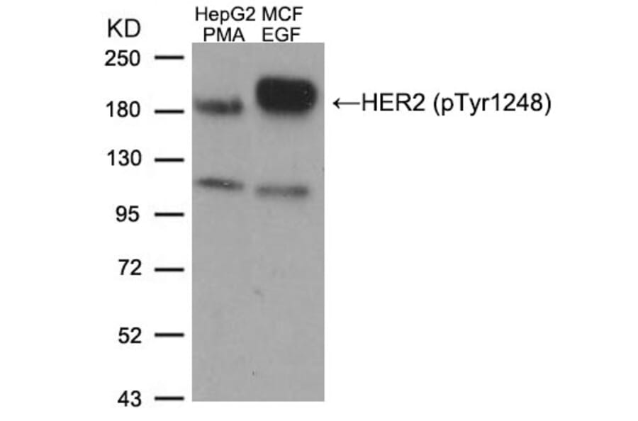 Western blot - HER2 (Phospho-Tyr1248) Antibody from Signalway Antibody (11079) - Antibodies.com