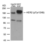 Western blot - HER2 (Phospho-Tyr1248) Antibody from Signalway Antibody (11079) - Antibodies.com