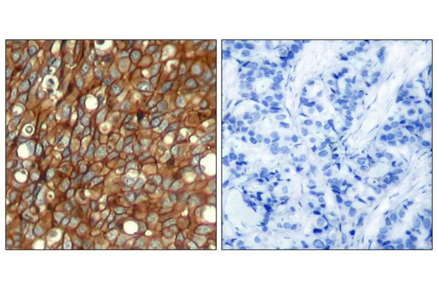 Immunohistochemistry - HER2 (Phospho-Tyr1248) Antibody from Signalway Antibody (11079) - Antibodies.com
