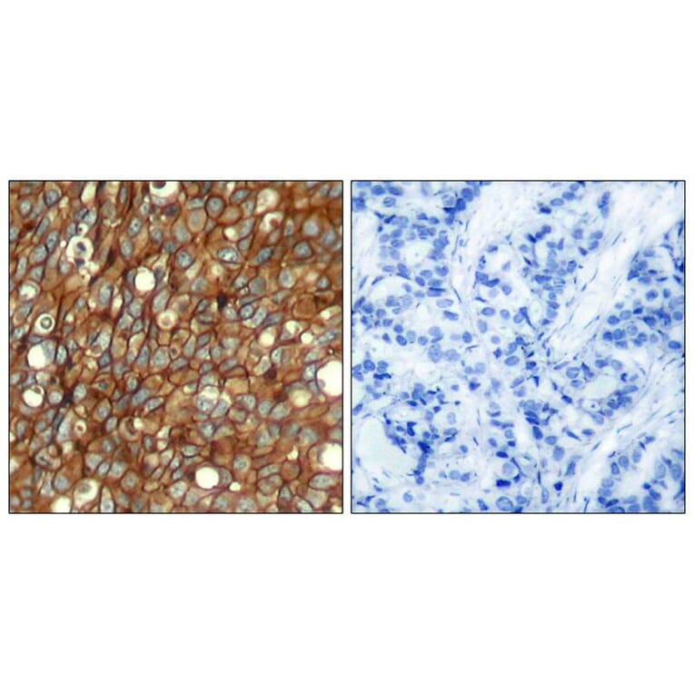 Immunohistochemistry - HER2 (Phospho-Tyr1248) Antibody from Signalway Antibody (11079) - Antibodies.com
