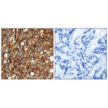 Immunohistochemistry - HER2 (Phospho-Tyr1248) Antibody from Signalway Antibody (11079) - Antibodies.com