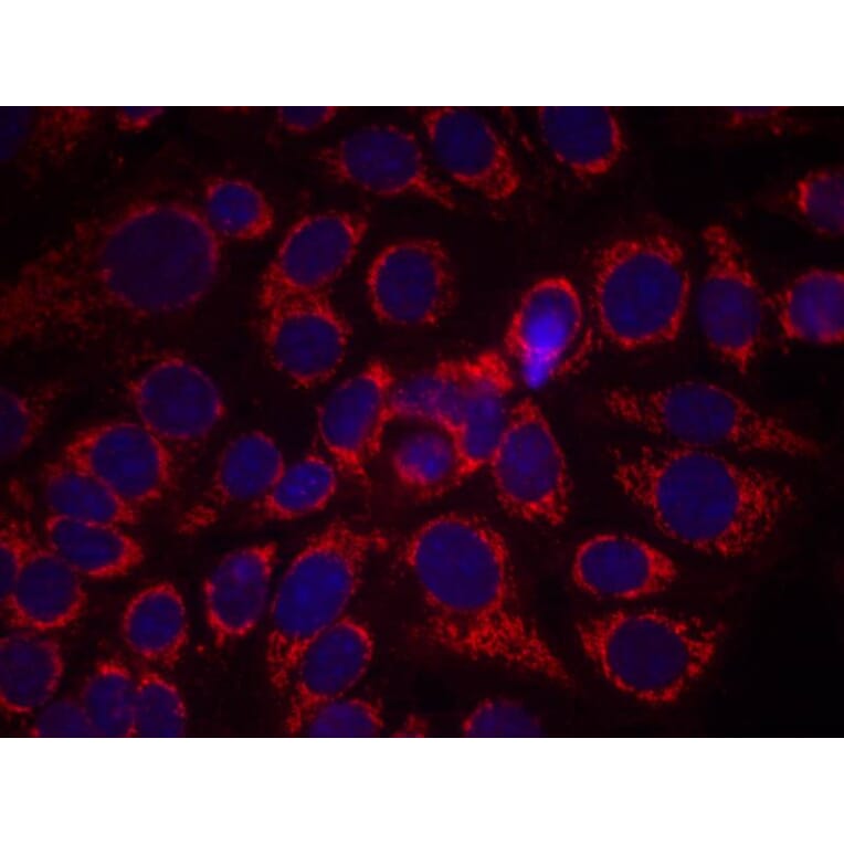 Immunofluorescence - HER2 (Phospho-Tyr1248) Antibody from Signalway Antibody (11079) - Antibodies.com