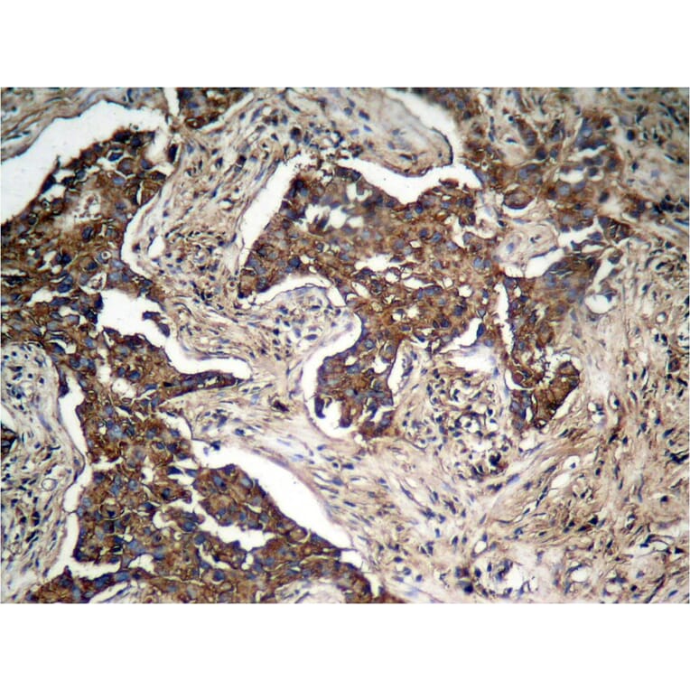 Immunohistochemistry - HER2 (Phospho-Tyr1248) Antibody from Signalway Antibody (11079) - Antibodies.com