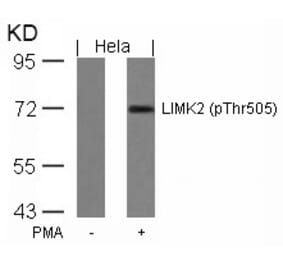 Western blot - LIMK2 (Phospho-Thr505) Antibody from Signalway Antibody (11127) - Antibodies.com
