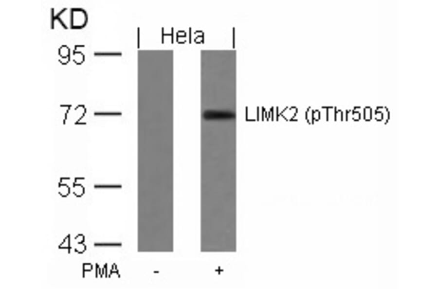 Western blot - LIMK2 (Phospho-Thr505) Antibody from Signalway Antibody (11127) - Antibodies.com