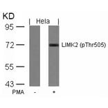 Western blot - LIMK2 (Phospho-Thr505) Antibody from Signalway Antibody (11127) - Antibodies.com