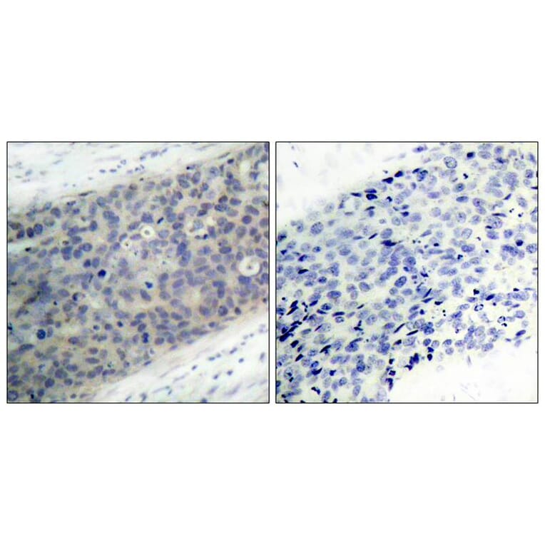 Immunohistochemistry - LIMK2 (Phospho-Thr505) Antibody from Signalway Antibody (11127) - Antibodies.com