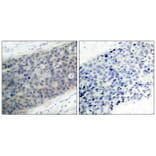 Immunohistochemistry - LIMK2 (Phospho-Thr505) Antibody from Signalway Antibody (11127) - Antibodies.com