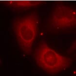 Immunofluorescence - LIMK2 (Phospho-Thr505) Antibody from Signalway Antibody (11127) - Antibodies.com
