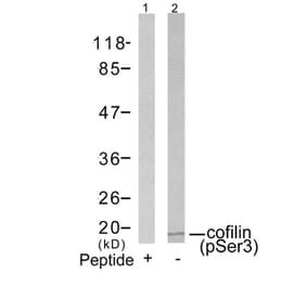 Western blot - cofilin (Phospho-Ser3) Antibody from Signalway Antibody (11139) - Antibodies.com
