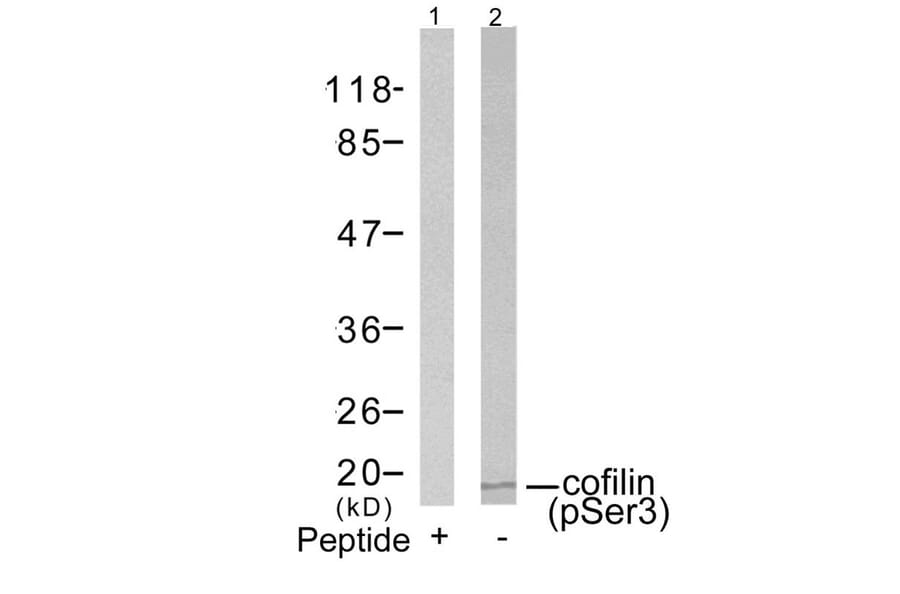 Western blot - cofilin (Phospho-Ser3) Antibody from Signalway Antibody (11139) - Antibodies.com