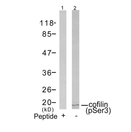Western blot - cofilin (Phospho-Ser3) Antibody from Signalway Antibody (11139) - Antibodies.com