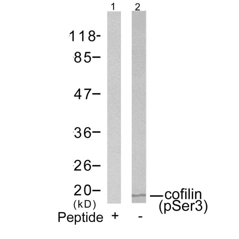 Western blot - cofilin (Phospho-Ser3) Antibody from Signalway Antibody (11139) - Antibodies.com