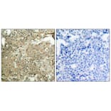 Immunohistochemistry - cofilin (Phospho-Ser3) Antibody from Signalway Antibody (11139) - Antibodies.com