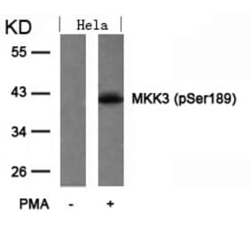 Western blot - MKK3 (Phospho-Ser189) Antibody from Signalway Antibody (11145) - Antibodies.com