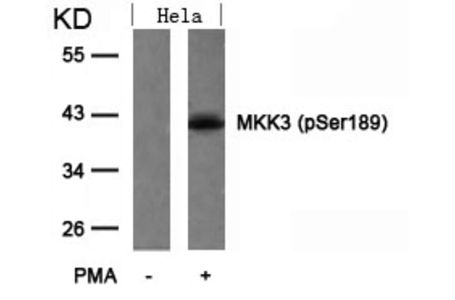 Western blot - MKK3 (Phospho-Ser189) Antibody from Signalway Antibody (11145) - Antibodies.com